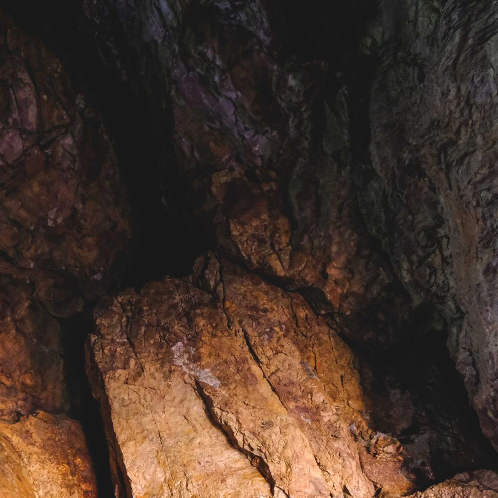 Bruxismo: por qué aprietas los dientes y qué soluciones pueden ayudarte